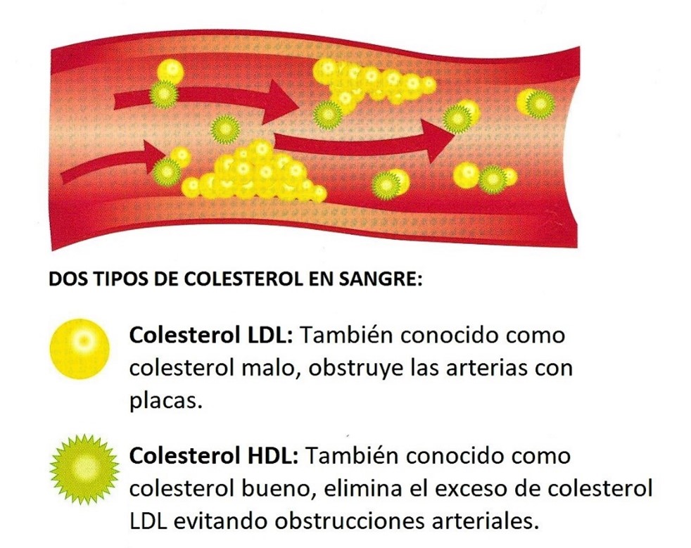 Colesterol bueno (HDL) y colesterol malo (LDL).